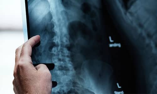 High-quality X-ray Test 