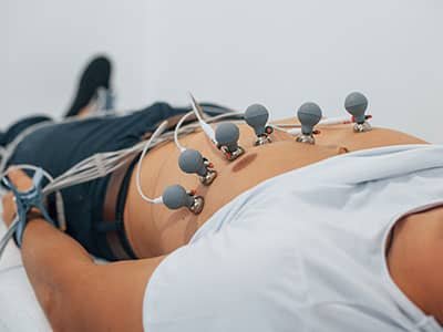 ECG