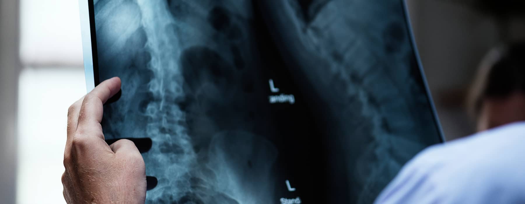 High-quality X-ray Test Niraamayadiagnostics